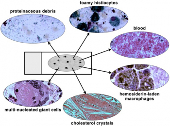 CTN Figure1